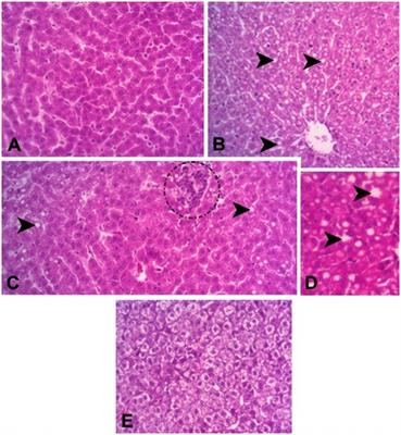 Metabolic profile of goats fed diets containing crude glycerin from biodiesel production
